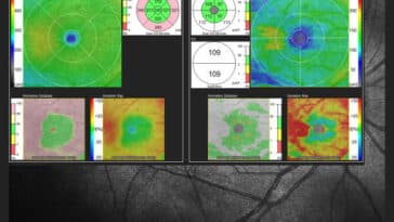 LiDAR Vision par ordinateur